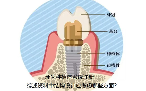 牙齒種植體系統(tǒng)注冊(cè).jpg