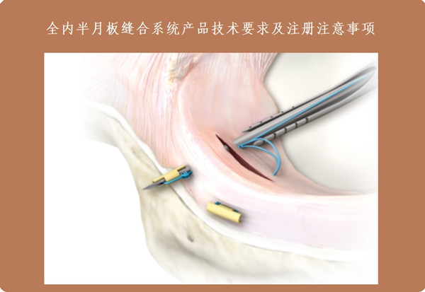 全內(nèi)半月板縫合系統(tǒng)產(chǎn)品技術要求.jpg