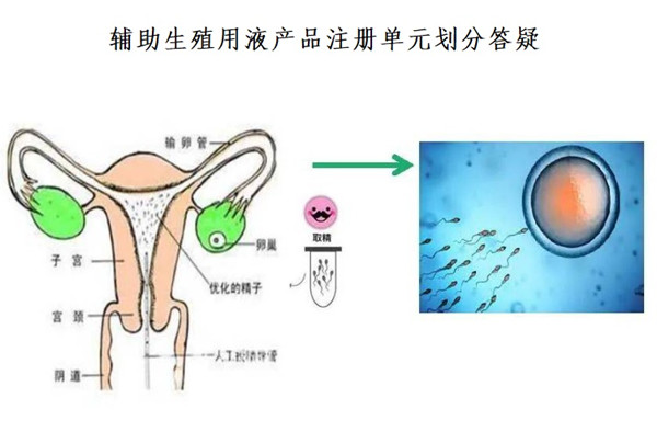 辅助生殖用液产品注册.jpg