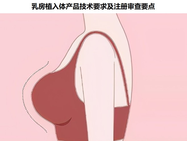 乳房植入體產(chǎn)品技術(shù)要求.jpg