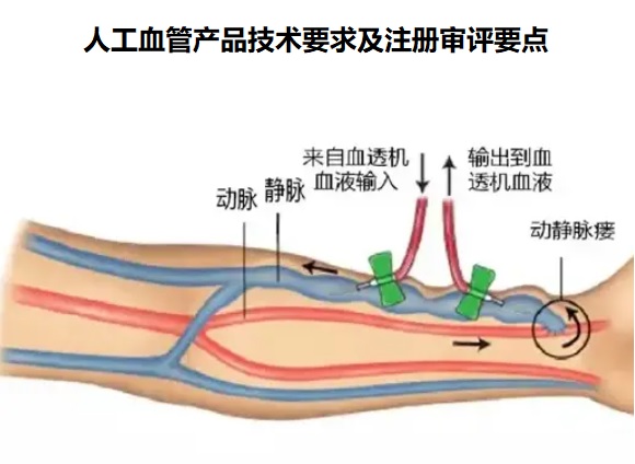 人工血管產(chǎn)品技術(shù)要求.jpg