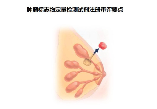 腫瘤標(biāo)志物定量檢測試劑注冊.jpg